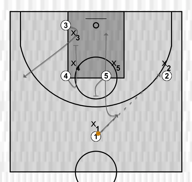 Jogada de basquete bi     , passo 2: 5 estabelece uma tela firme para liberar um companheiro e criar oportunidades próximas de arremesso