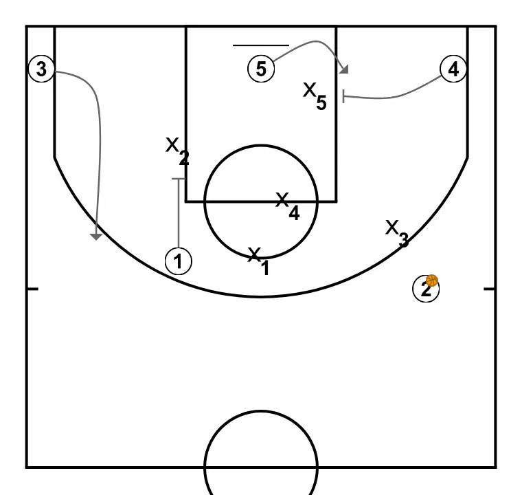 4 – Alero Bajo - PAS 6: 4 planta un screen per millorar l’angle d’atac i facilitar la recepció de la pilota